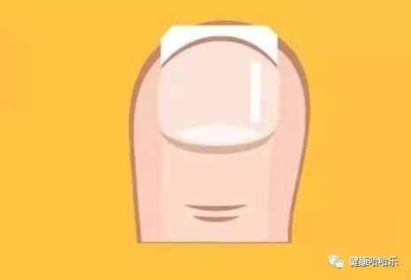 指甲没剪好怎么修复,指甲没做好怎么补救