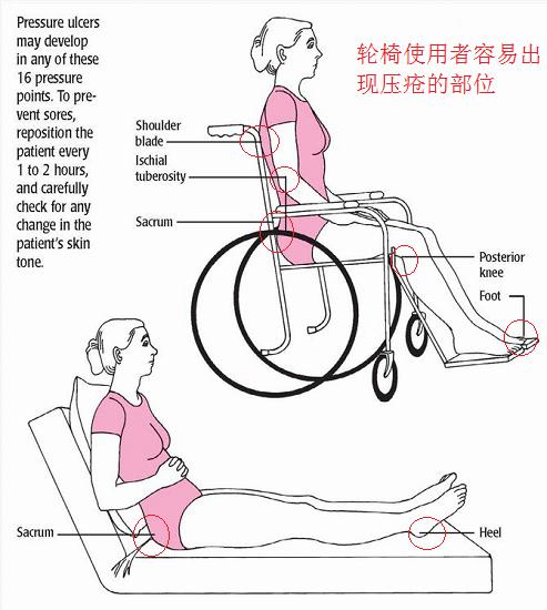 如何使用和护理轮椅,使用轮椅的注意事项有哪些