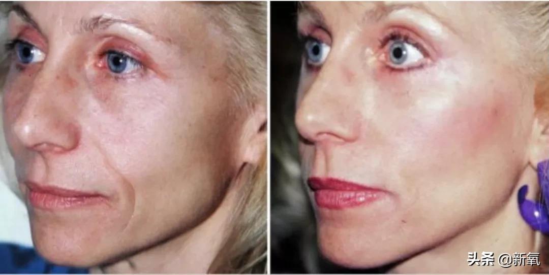 不老仙妻冻龄,不老仙妻40多岁看起来仅20岁