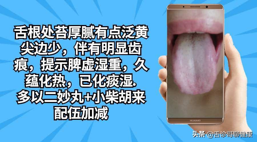 抖音舌诊哥,舌诊哥视频