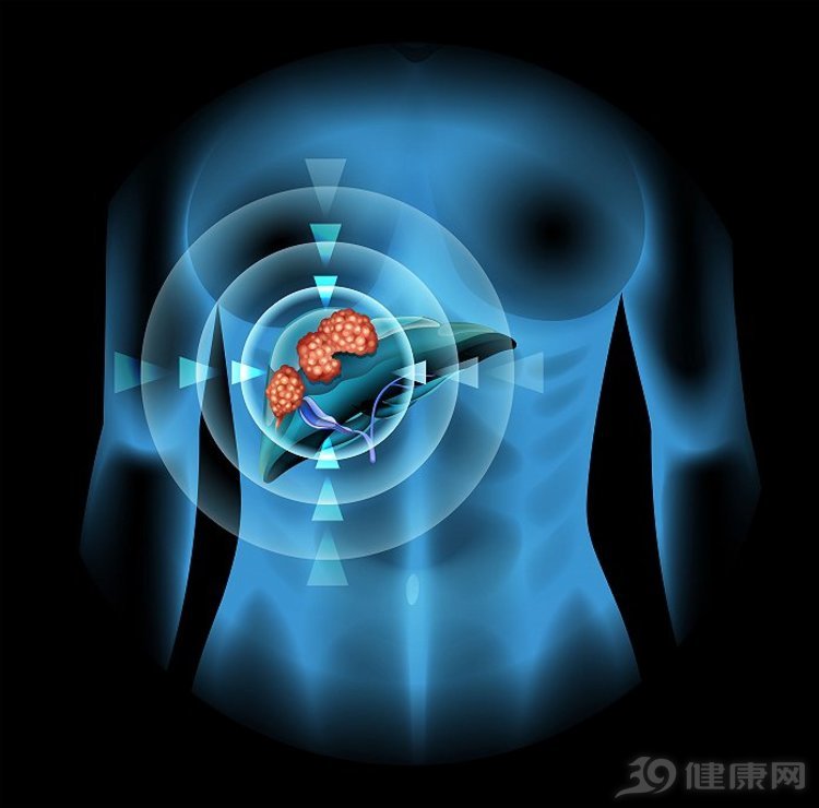 甲胎蛋白3倍严重吗,甲胎蛋白3点多需要吃药吗