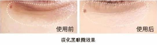 肖战敷面膜现身,肖战眼膜