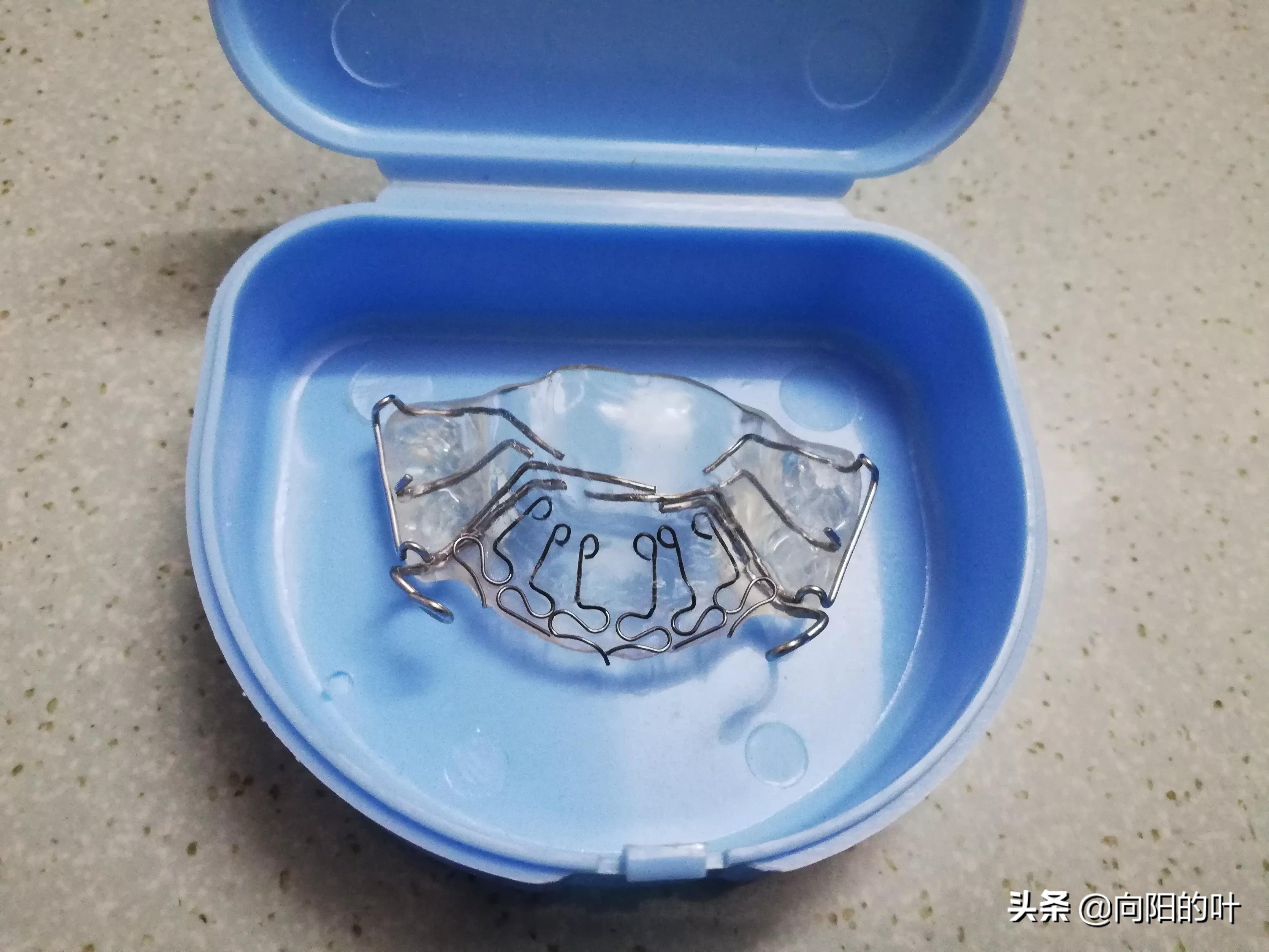 儿童兜齿正畸注意事项,小孩兜齿治疗最佳时间