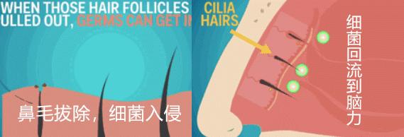 鼻毛长出来了正确处理方法,鼻毛长出来是拔掉还是剪掉