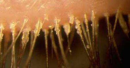 孩子频繁眨眼眼睛往上翻,孩子频繁眨眼是怎么回事