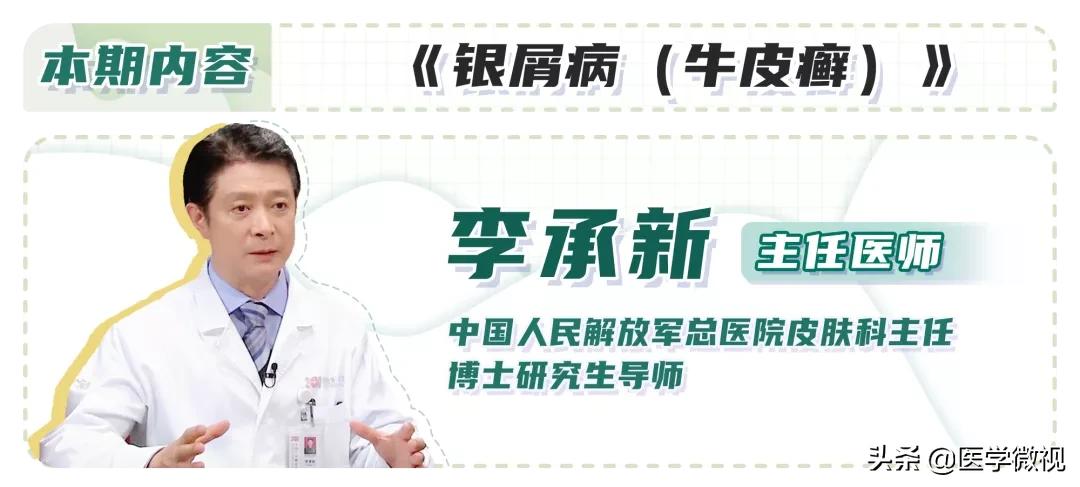 什么样的牛皮癣皮肤会痒烂,牛皮癣冬季瘙痒怎么治