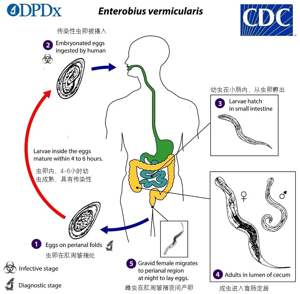 现在小学生要打虫吗,孩子打虫的季节
