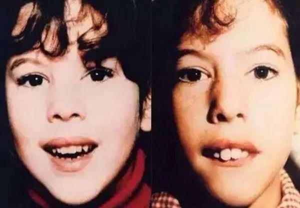 每位妈妈都可以帮助宝宝更美做的微整形,快行动起来