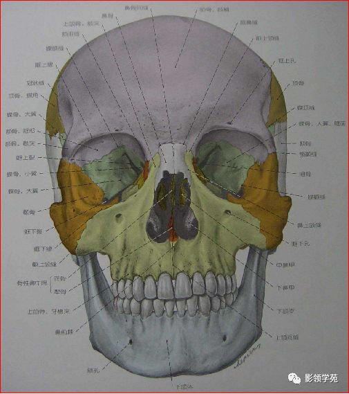 鼻骨骨折的检查方法,鼻骨骨折影像学表现