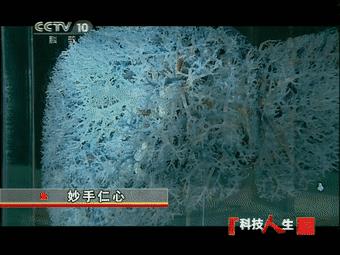 罗大伦讲中医治疗肝癌,中国肝胆外科之父吴孟超简介50字