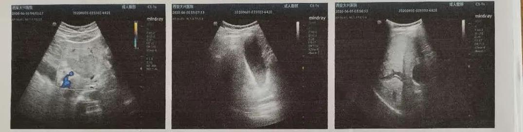 男子腹痛却找不出原因,男子腹痛难忍却查不出原因