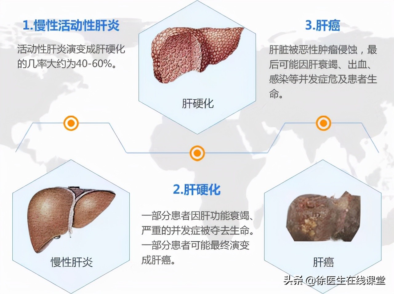 孕妇谷丙转氨酶和谷草转氨酶高200,谷丙转氨酶50谷草转氨酶40正常吗
