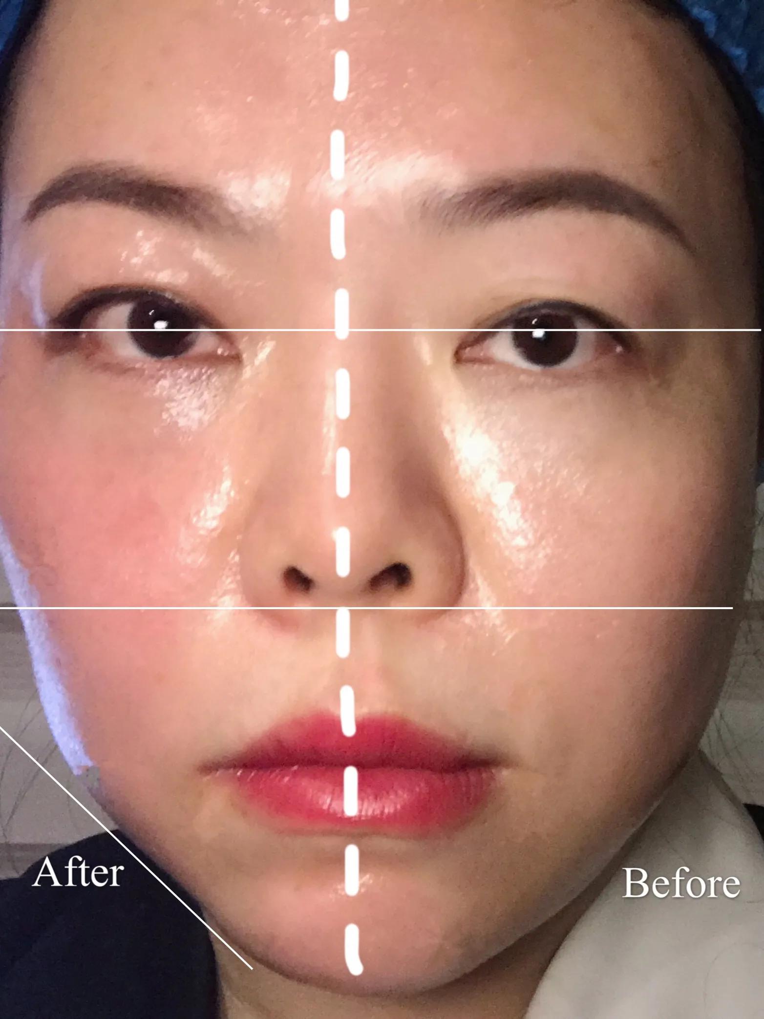 医疗美容去斑做什么项目最好,过年必做的4个医美项目