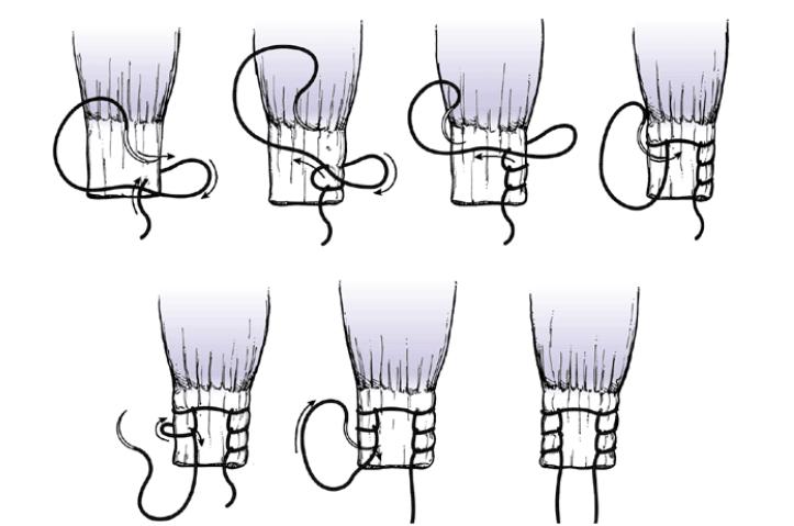 球星谈论科比跟腱断裂,球星跟腱断裂代表着什么