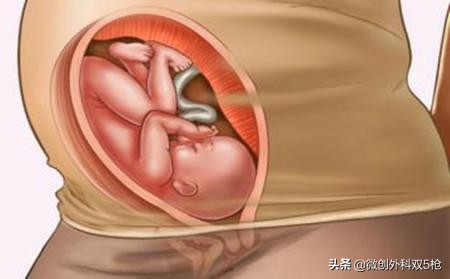 男人永远无法理解女人怀孕的痛苦,男人不懂女生怀孕有多难