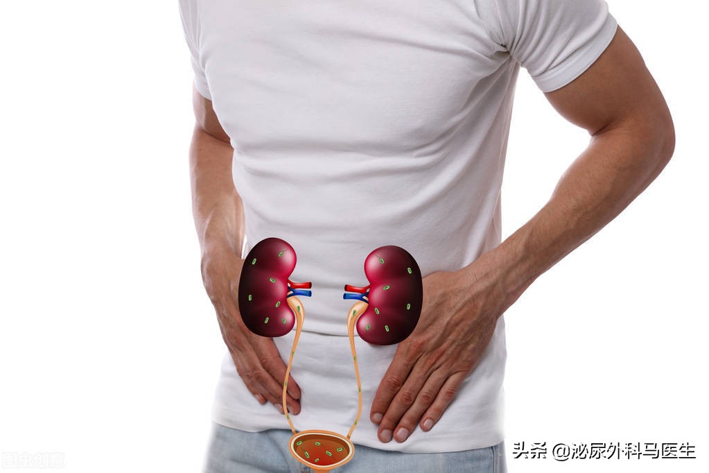 男性尿路感染能完全用中医治疗吗,男性尿路感染一般几天自愈