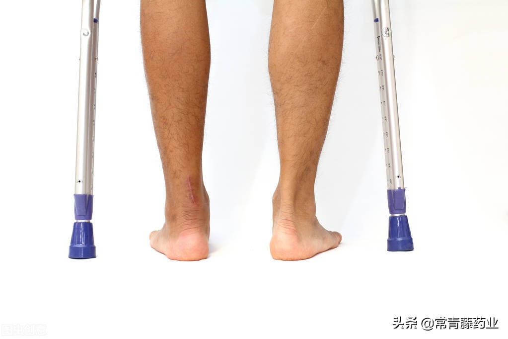 跟腱断裂手术开放式好还是微创好,跟腱断裂以后最难受的是什么