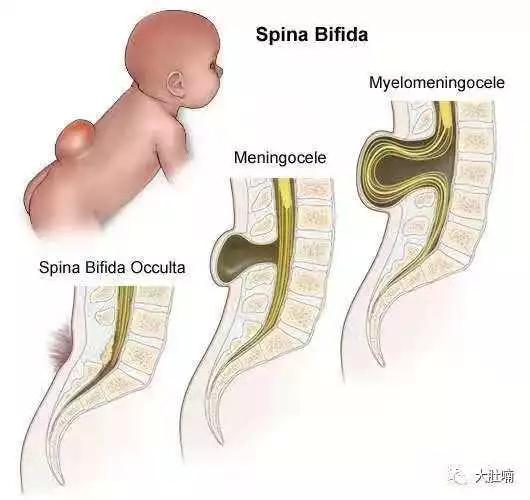 叶酸品牌推荐老爸评测,叶酸品牌推荐指数