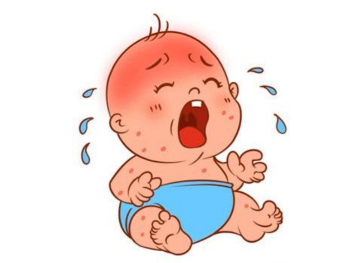 儿童湿疹常见的三大原因,家长要如何护理湿疹宝宝比较好