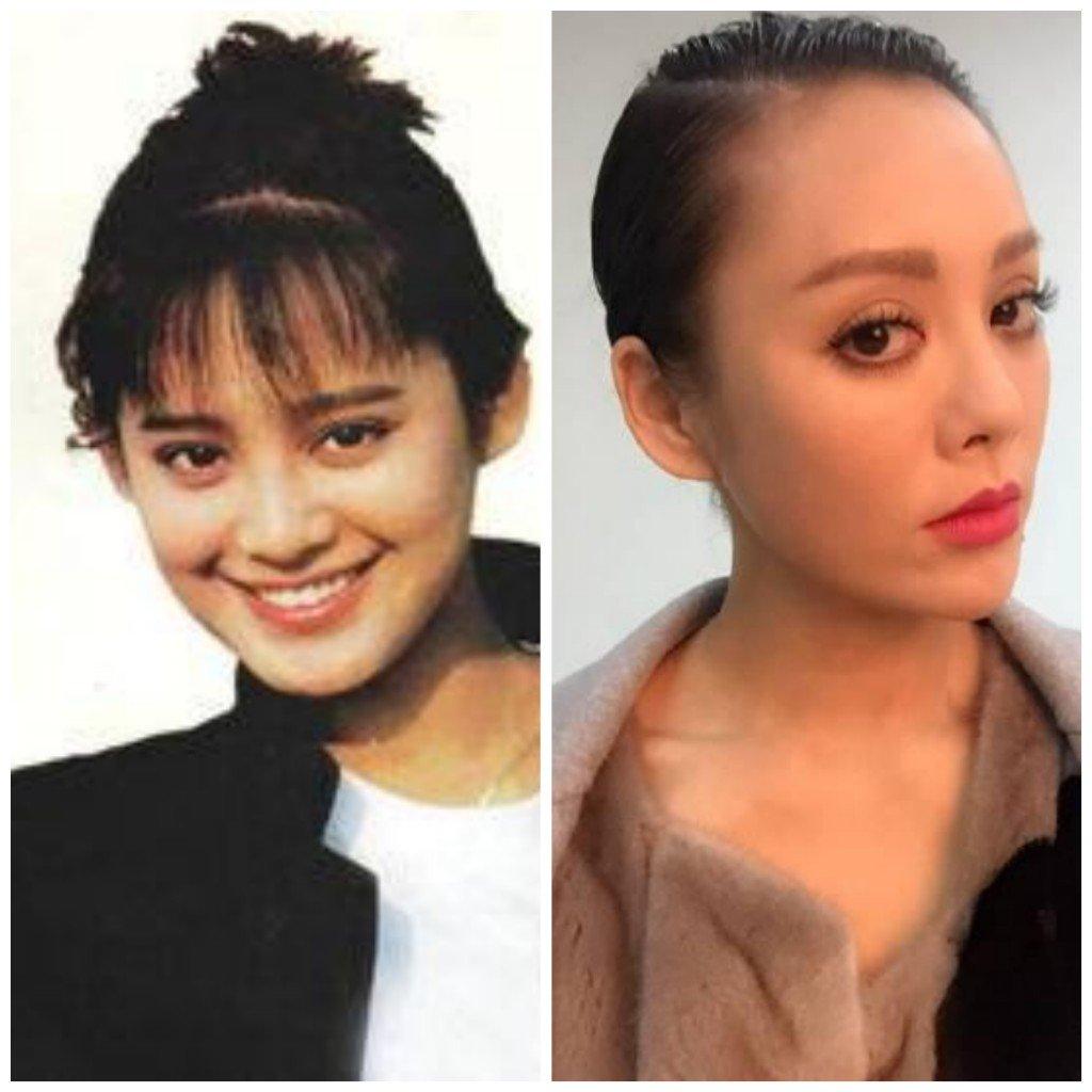 抗衰老蜗牛,蜗牛护肤品抗皱抗衰老