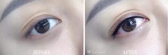 美瞳线纹绣正确操作手法,美瞳线纹绣什么颜色最好看