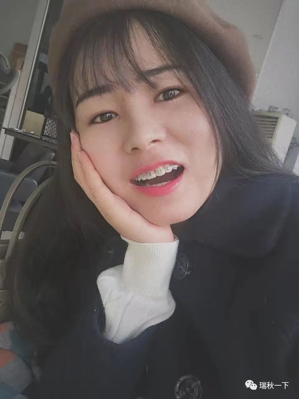 牙齿矫正,你后悔了吗?