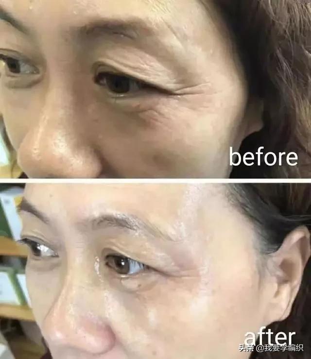 冬天脸干，连皱纹都出来了？日本女博士教你一招，抹几下白白嫩嫩