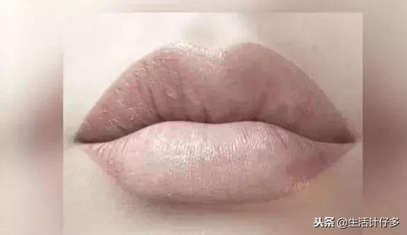 嘴唇发白没有血色是因为什么,嘴唇没血色跟身体哪个器官有关系