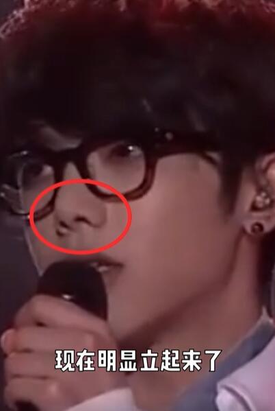 美妆网红晒华晨宇变脸过程质疑其做了3项整容手术，真的不怕被告