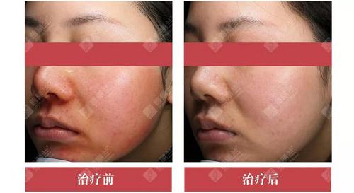 婴儿时光机美白,婴儿时光肌