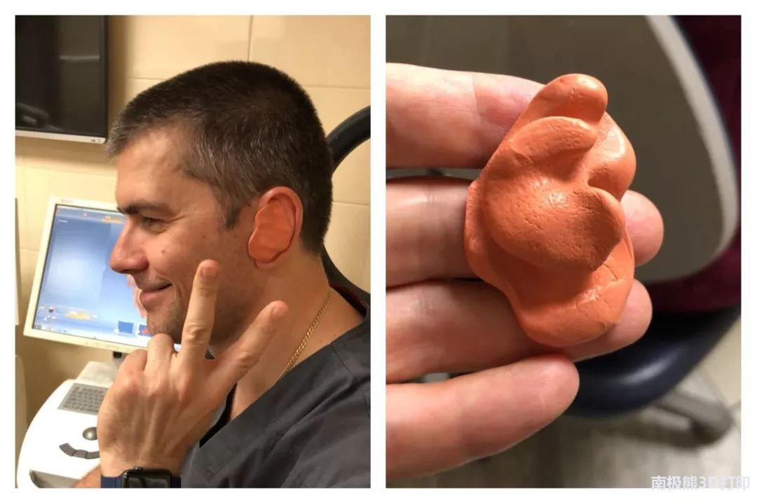 airpods鑰虫満3d鎵撳嵃,3d鎵撳嵃airpods