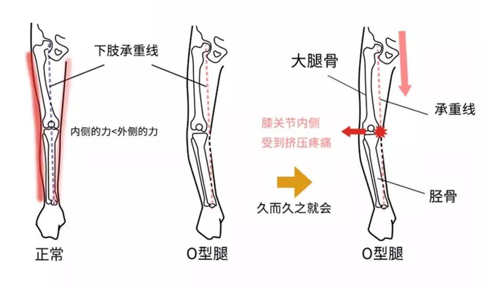 怎么练成大长腿懒人动作,如何练成笔直大长腿
