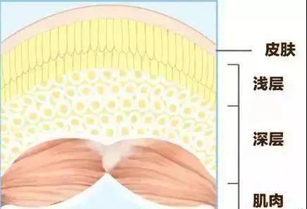 杨幂林志玲纱裙,林志玲杨幂都在用的瘦腿8招