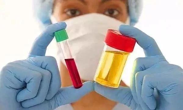 尿酸到底是什么引起的,尿酸是自身原因吗