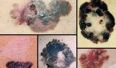 皮肤科主任王教授,上海中医院皮肤科王教授