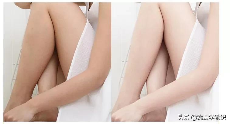 冬天干燥皮肤蛇皮,冬天冷皮肤粗糙