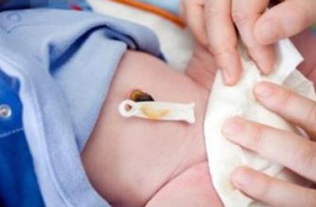 新生宝宝肚脐凸出来了怎么办,新生儿一个月肚脐眼会鼓起来吗