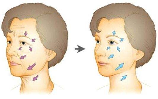 怎么淡化防晒导致的色斑 (淡化色斑防晒)