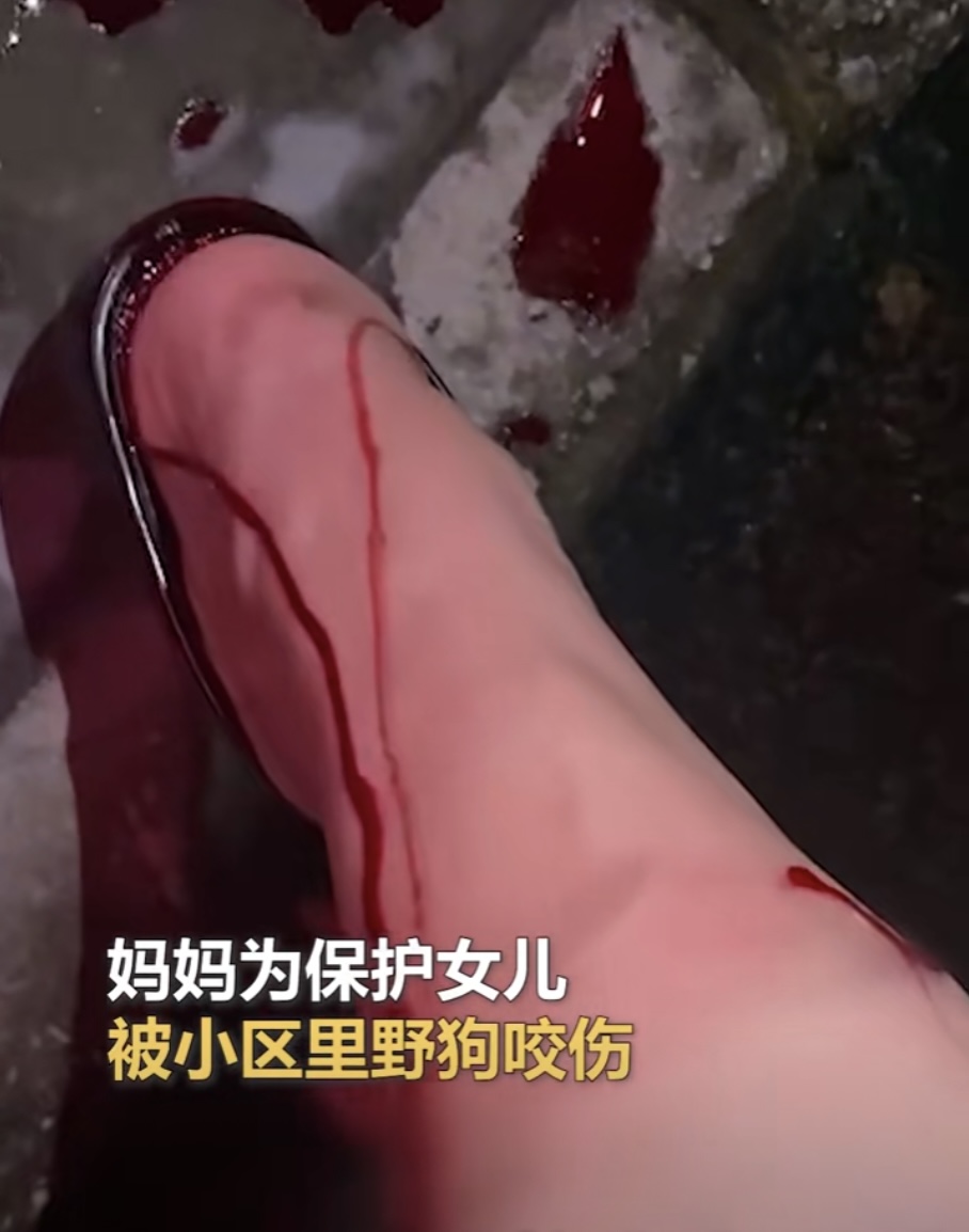 咬伤女童黑犬如何处置,被野狗咬伤如何索赔找不到主人