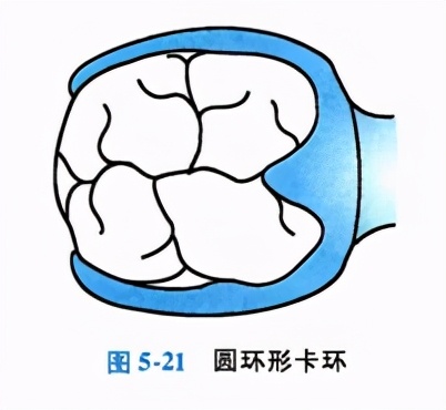 牙列缺损的可摘局部义齿修复题库,牙科美学修复精讲