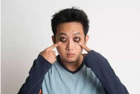 黑眼圈特别严重怎么办消除,黑眼圈严重怎么办才能彻底去除