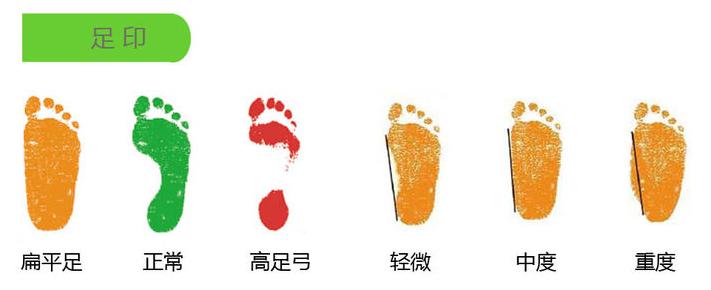 足底平是什么,足底凹凸不平