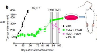 乳腺癌15种锻炼方法,断食或能阻挡乳腺癌发展