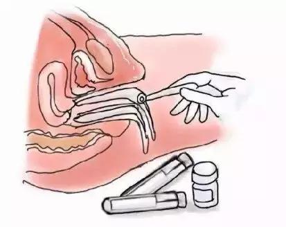 子宫“问题百出”，妇科检查到底做哪些？