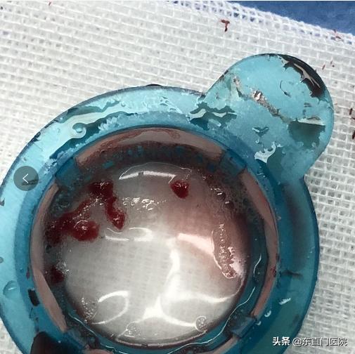 精确规范力挽狂澜