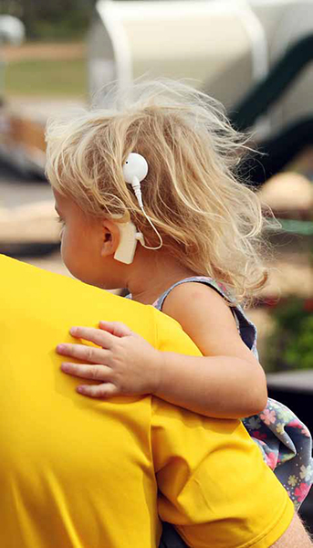 人工耳蜗怎么戴到头上,人工耳蜗怎么佩戴在头上