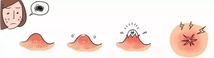 青春痘痘印怎样去除,如何有效的祛除痘印黑色和红色的