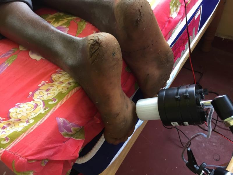 如何避免足底外侧老茧,脚上有老茧怎么样才能让脚好看