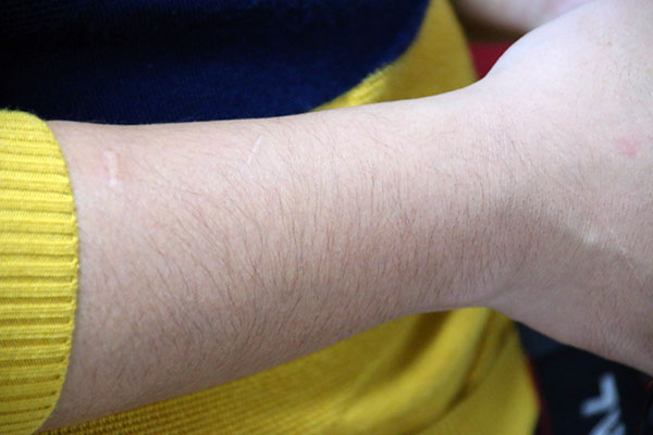 男性腿毛浓密说明什么,男性腿毛多的人说明什么