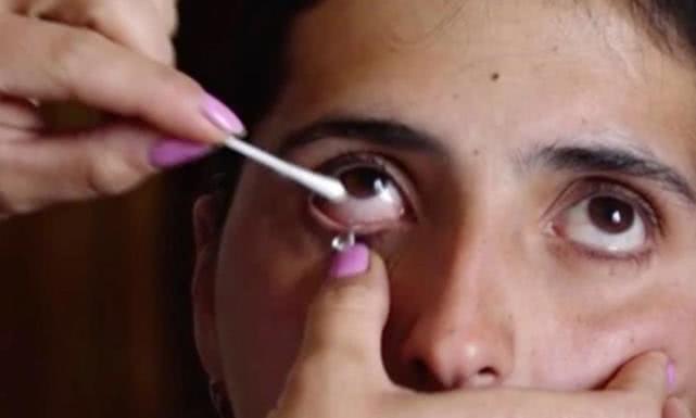 女子得了罕见怪病眼睛流出血,女子眼睛流出钻石眼泪